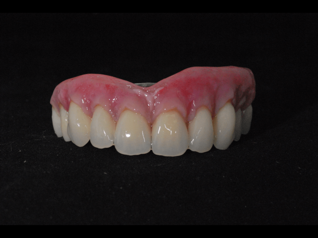 Denture repair