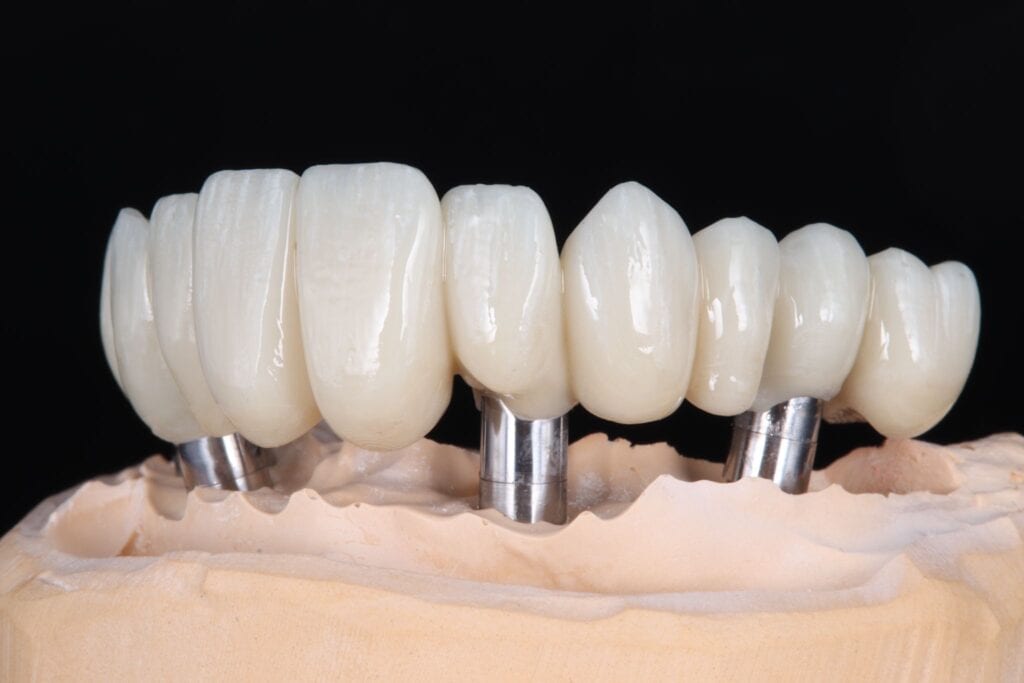 WhatsApp Image 2023-11-20 at 12.34.21